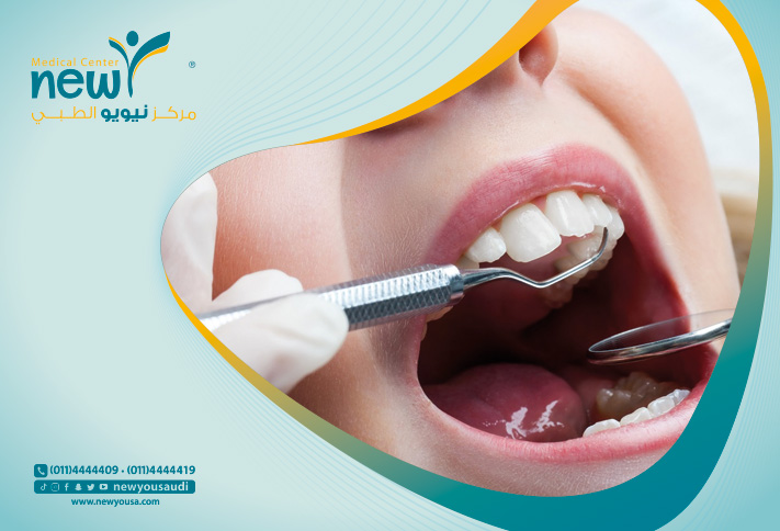 اسباب تسوس الأسنان كل ما تريد معرفته عنه من خلال مركزنا الطبي في السعودية | نيويو