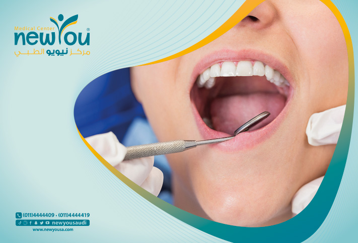اسباب تسوس الاسنان الامامية تعرف عليها من خلال مركزنا الطبي في السعودية | نيويو