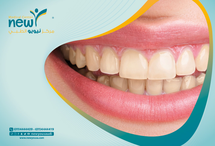 الأشعة الرقمية للأسنان كل ما تريد معرفته عنها من خلال مركزنا الطبي في السعودية | نيويو
