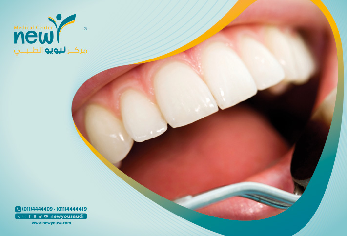 علاج بروز الأسنان تعرف عليه من خلال مركزنا الطبي في السعودية | نيويو