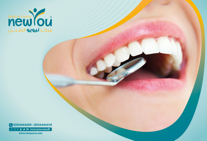 مضاعفات تسوس الأسنان كل ما تريد معرفته عنها من خلال مركزنا الطبي في السعودية | نيويو