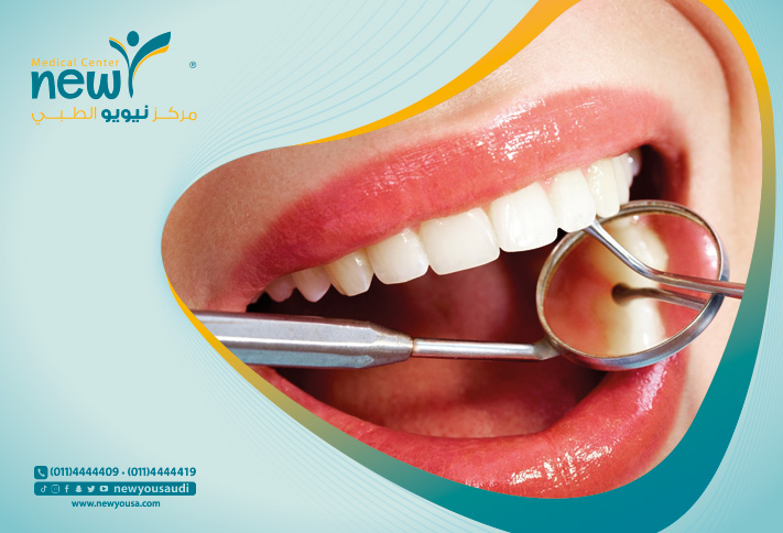 أنواع الأسنان تعرف عليه من خلال مركزنا الطبي في السعودية | نيويو