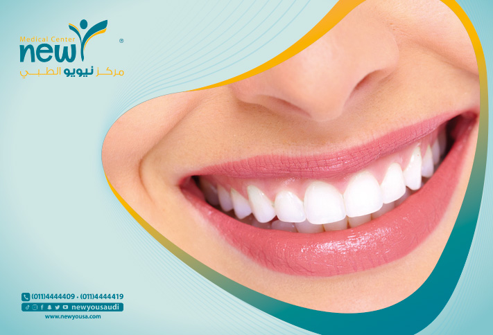 اسباب تآكل الأسنان الأمامية تعرف عليها من خلال مركزنا الطبي في السعودية | نيويو