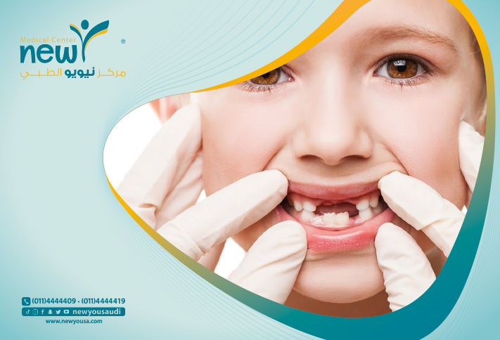 خراج الأسنان عند الأطفال كل ما تريد معرفته عنه من خلال مركزنا الطبي في السعودية | نيويو