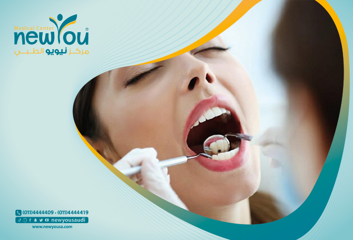 تسوس الأسنان تعرف عليه من خلال مركزنا الطبي في السعودية | نيويو
