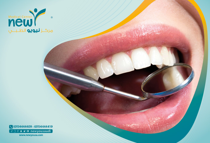 أطعمة تقوي الأسنان واللثة تعرف عليها من خلال مركزنا الطبي في السعودية | نيويو