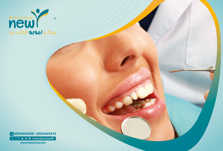 طرق تسكين ألم الاسنان تعرف عليها من خلال مركزنا الطبي في السعودية | نيويو