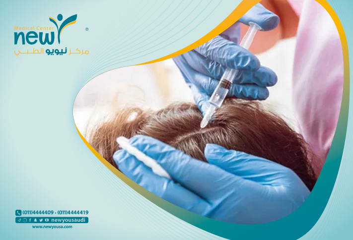 تقنية بلازما الشعر كل ما تريد معرفته عنها من خلال مركزنا الطبي في السعودية | نيويو