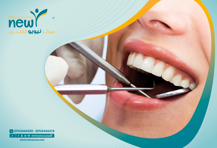 تجميل الأسنان كل ما تريد معرفته عنه من خلال مركزنا الطبي في السعودية | نيويو