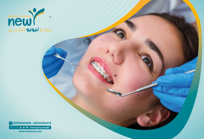 أنواع تقويم الأسنان تعرف عليه من خلال مركزنا الطبي في السعودية | نيويو