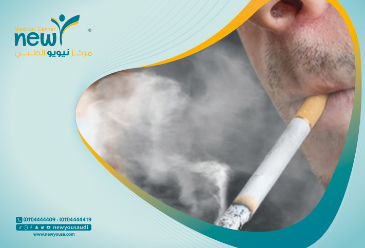 التدخين والجراحة التجميلية كل ما تريد معرفته عنها من خلال مركزنا الطبي في السعودية | نيويو
