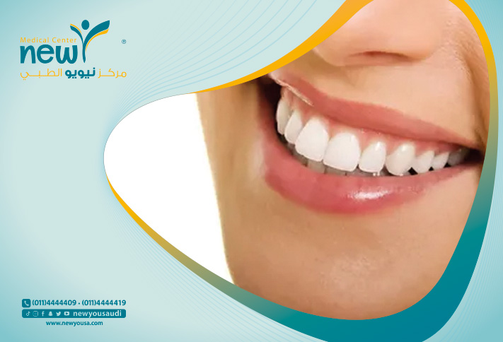 تقنية الزوم 4 لتبيض الاسنان كل ما تريد معرفته عنها من خلال مركزنا الطبي في السعودية | نيويو