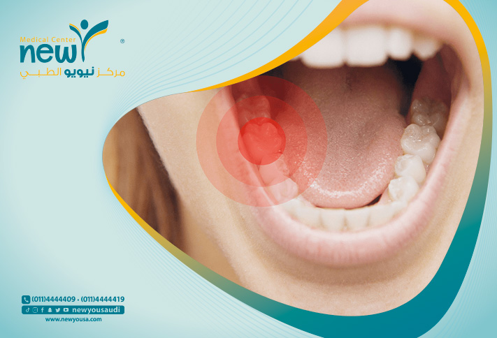 طرق تسكين ألم الأسنان كل ما تريد معرفته عنها من خلال مركزنا الطبي في السعودية | نيويو