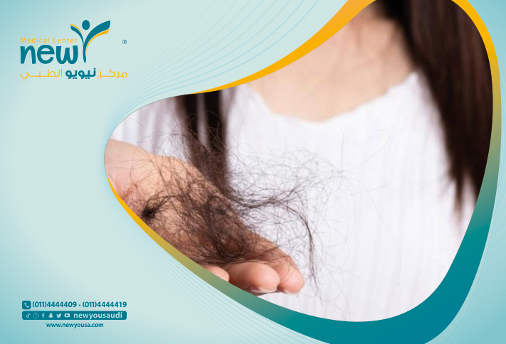 تساقط الشعر كل ما تريد معرفته عنها من خلال مركزنا الطبي في السعودية | نيويو