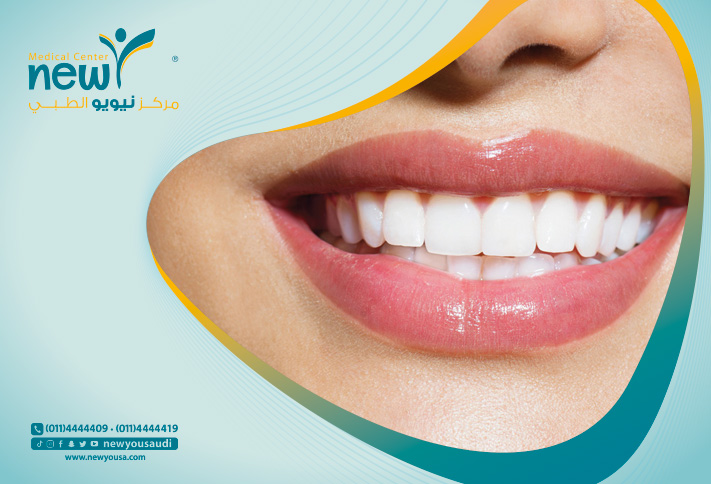 أسباب اصفرار الأسنان تعرف عليه من خلال مركزنا الطبي في السعودية | نيويو