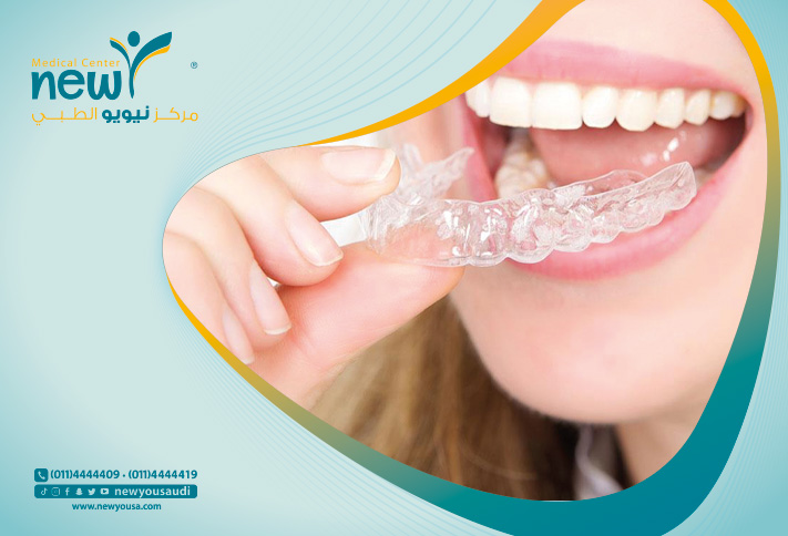 الحفاظ على صحة الاسنان تعرف عليها من خلال مركزنا الطبي في السعودية | نيويو