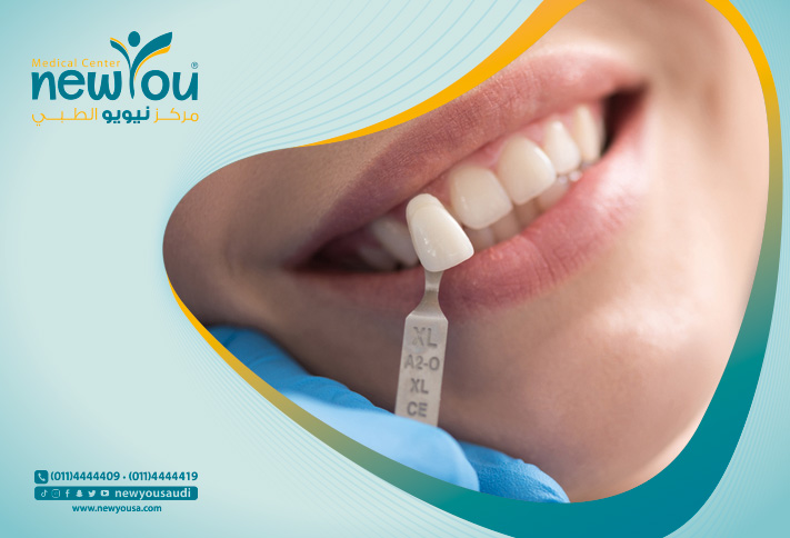 مخاطر زراعة الأسنان تعرف عليها من خلال مركزنا الطبي في السعودية | نيويو
