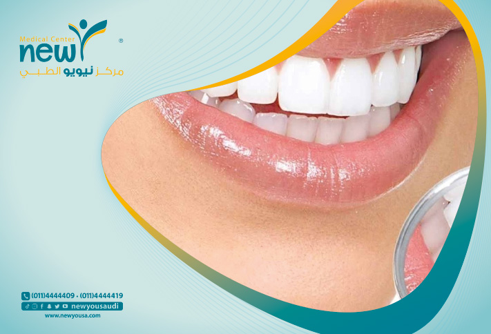 اسباب تصبغات الاسنان الاسنان كل ما تريد معرفته عنها من خلال مركزنا الطبي في السعودية | نيويو
