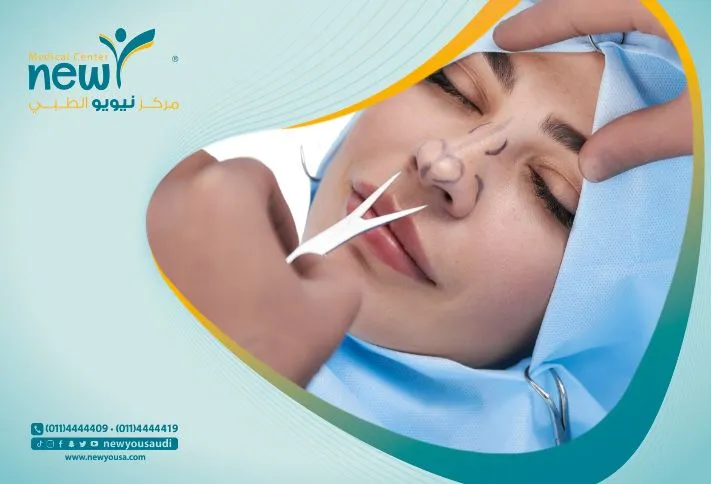 ممنوعات بعد عملية تجميل الأنف: نصائح هامة للتعافي السريع