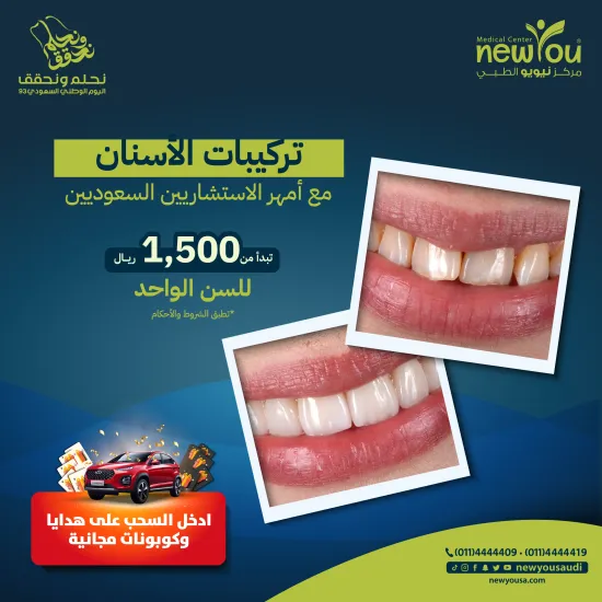 تركيبات الأسنان - السن الواحد -