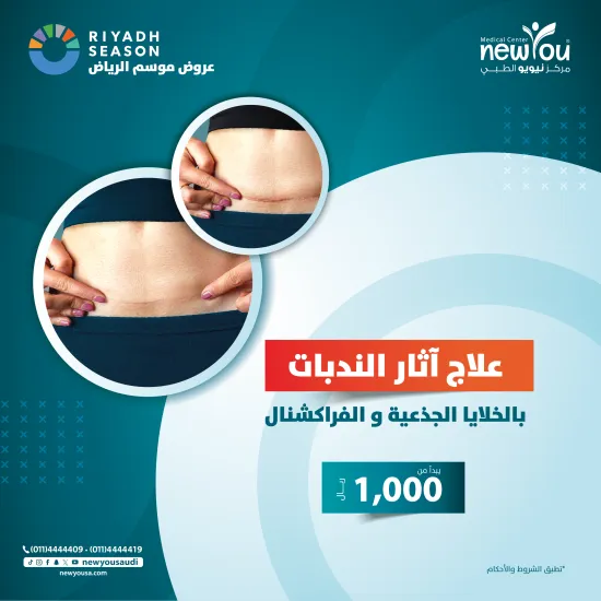 علاج الندبات الجراحية